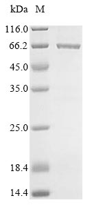 SDS-PAGE- Recombinant protein Escherichia cea