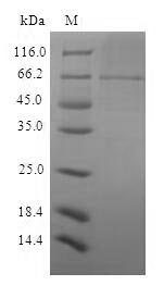 (Tris-Glycine gel) Discontinuous SDS-PAGE (reduced) with 5% enrichment gel and 15% separation gel. (Tris-Glycine gel) Discontinuous SDS-PAGE (reduced) with 5% enrichment gel and 15% separation gel.