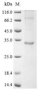 Recombinant Human papillomavirus type 16 Probable protein E5 (E5) - image 1