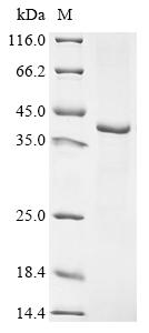 (Tris-Glycine gel) Discontinuous SDS-PAGE (reduced) with 5% enrichment gel and 15% separation gel. (Tris-Glycine gel) Discontinuous SDS-PAGE (reduced) with 5% enrichment gel and 15% separation gel.