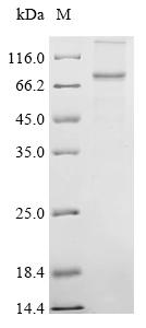 Recombinant Coxiella burnetII Hypothetical membrane spanning protein (CBU_1863) - image 1