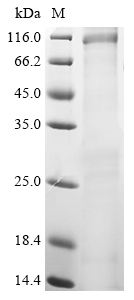 (Tris-Glycine gel) Discontinuous SDS-PAGE (reduced) with 5% enrichment gel and 15% separation gel.