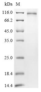 Recombinant Acinetobacter baumannII Efflux pump membrane transporter (HMPREF0010_00594) - image 1