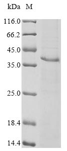 (Tris-Glycine gel) Discontinuous SDS-PAGE (reduced) with 5% enrichment gel and 15% separation gel. (Tris-Glycine gel) Discontinuous SDS-PAGE (reduced) with 5% enrichment gel and 15% separation gel.