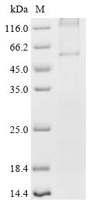 Recombinant Human Frizzled-2 (FZD2) - image 1