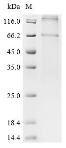 Recombinant Bovine Parathyroid hormone/parathyroid hormone-related peptide receptor (PTH1R) - image 1