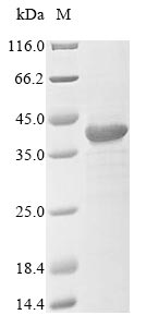 (Tris-Glycine gel) Discontinuous SDS-PAGE (reduced) with 5% enrichment gel and 15% separation gel. (Tris-Glycine gel) Discontinuous SDS-PAGE (reduced) with 5% enrichment gel and 15% separation gel.