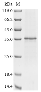 (Tris-Glycine gel) Discontinuous SDS-PAGE (reduced) with 5% enrichment gel and 15% separation gel. (Tris-Glycine gel) Discontinuous SDS-PAGE (reduced) with 5% enrichment gel and 15% separation gel.