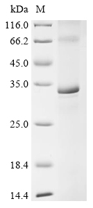 Recombinant Mouse E3 ubiquitin-protein ligase MARCH5 (Marchf5) - image 1