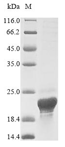 (Tris-Glycine gel) Discontinuous SDS-PAGE (reduced) with 5% enrichment gel and 15% separation gel. (Tris-Glycine gel) Discontinuous SDS-PAGE (reduced) with 5% enrichment gel and 15% separation gel.