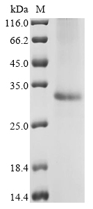(Tris-Glycine gel) Discontinuous SDS-PAGE (reduced) with 5% enrichment gel and 15% separation gel. (Tris-Glycine gel) Discontinuous SDS-PAGE (reduced) with 5% enrichment gel and 15% separation gel.