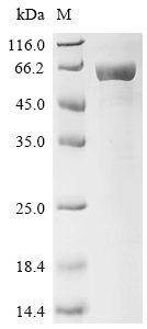 Recombinant Pongo abelII Neurofilament light polypeptide (NEFL) , partial - image 1