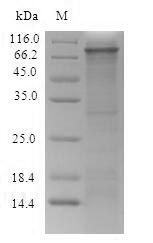 (Tris-Glycine gel) Discontinuous SDS-PAGE (reduced) with 5% enrichment gel and 15% separation gel. (Tris-Glycine gel) Discontinuous SDS-PAGE (reduced) with 5% enrichment gel and 15% separation gel.