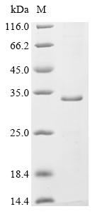 (Tris-Glycine gel) Discontinuous SDS-PAGE (reduced) with 5% enrichment gel and 15% separation gel. (Tris-Glycine gel) Discontinuous SDS-PAGE (reduced) with 5% enrichment gel and 15% separation gel.