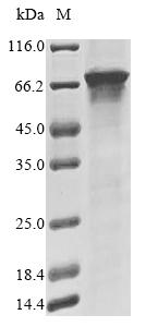 Recombinant Human Terminal nucleotidyltransferase 4A (TENT4A) , partial - image 1