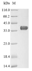 (Tris-Glycine gel) Discontinuous SDS-PAGE (reduced) with 5% enrichment gel and 15% separation gel. (Tris-Glycine gel) Discontinuous SDS-PAGE (reduced) with 5% enrichment gel and 15% separation gel.
