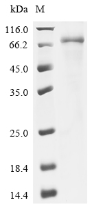 (Tris-Glycine gel) Discontinuous SDS-PAGE (reduced) with 5% enrichment gel and 15% separation gel. (Tris-Glycine gel) Discontinuous SDS-PAGE (reduced) with 5% enrichment gel and 15% separation gel.
