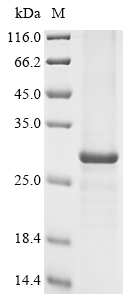 Recombinant Human STEAP family member 1B (STEAP1B) - image 1