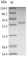 (Tris-Glycine gel) Discontinuous SDS-PAGE (reduced) with 5% enrichment gel and 15% separation gel. (Tris-Glycine gel) Discontinuous SDS-PAGE (reduced) with 5% enrichment gel and 15% separation gel.