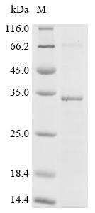 Recombinant Human Membrane progestin receptor alpha (PAQR7) - image 1