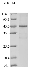 (Tris-Glycine gel) Discontinuous SDS-PAGE (reduced) with 5% enrichment gel and 15% separation gel. (Tris-Glycine gel) Discontinuous SDS-PAGE (reduced) with 5% enrichment gel and 15% separation gel.