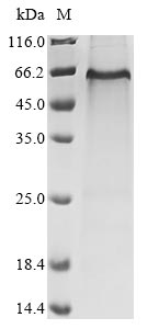 (Tris-Glycine gel) Discontinuous SDS-PAGE (reduced) with 5% enrichment gel and 15% separation gel. (Tris-Glycine gel) Discontinuous SDS-PAGE (reduced) with 5% enrichment gel and 15% separation gel.