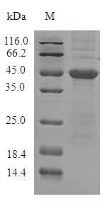(Tris-Glycine gel) Discontinuous SDS-PAGE (reduced) with 5% enrichment gel and 15% separation gel. (Tris-Glycine gel) Discontinuous SDS-PAGE (reduced) with 5% enrichment gel and 15% separation gel.