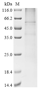 (Tris-Glycine gel) Discontinuous SDS-PAGE (reduced) with 5% enrichment gel and 15% separation gel. (Tris-Glycine gel) Discontinuous SDS-PAGE (reduced) with 5% enrichment gel and 15% separation gel.