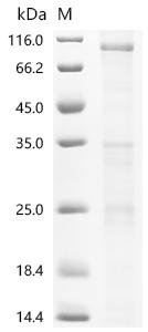 Recombinant Mouse Transient receptor potential cation channel subfamily V member 6 (Trpv6) - image 1