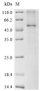 Recombinant Human Metalloreductase STEAP2 (STEAP2) - image 1