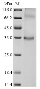 Recombinant Mouse Probable G-protein coupled receptor 146 (Gpr146) - image 1