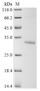 (Tris-Glycine gel) Discontinuous SDS-PAGE (reduced) with 5% enrichment gel and 15% separation gel. (Tris-Glycine gel) Discontinuous SDS-PAGE (reduced) with 5% enrichment gel and 15% separation gel.
