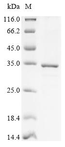 (Tris-Glycine gel) Discontinuous SDS-PAGE (reduced) with 5% enrichment gel and 15% separation gel. (Tris-Glycine gel) Discontinuous SDS-PAGE (reduced) with 5% enrichment gel and 15% separation gel.