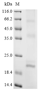 Recombinant Rat Claudin-5 (Cldn5) - image 1