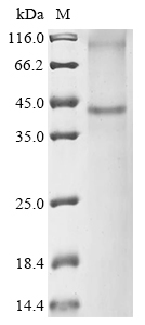 (Tris-Glycine gel) Discontinuous SDS-PAGE (reduced) with 5% enrichment gel and 15% separation gel. (Tris-Glycine gel) Discontinuous SDS-PAGE (reduced) with 5% enrichment gel and 15% separation gel.