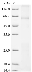 (Tris-Glycine gel) Discontinuous SDS-PAGE (reduced) with 5% enrichment gel and 15% separation gel. (Tris-Glycine gel) Discontinuous SDS-PAGE (reduced) with 5% enrichment gel and 15% separation gel.