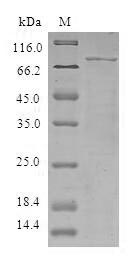 (Tris-Glycine gel) Discontinuous SDS-PAGE (reduced) with 5% enrichment gel and 15% separation gel. (Tris-Glycine gel) Discontinuous SDS-PAGE (reduced) with 5% enrichment gel and 15% separation gel.