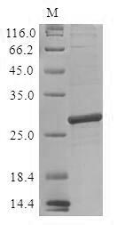 (Tris-Glycine gel) Discontinuous SDS-PAGE (reduced) with 5% enrichment gel and 15% separation gel. (Tris-Glycine gel) Discontinuous SDS-PAGE (reduced) with 5% enrichment gel and 15% separation gel.