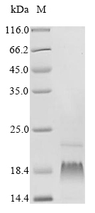 (Tris-Glycine gel) Discontinuous SDS-PAGE (reduced) with 5% enrichment gel and 15% separation gel. (Tris-Glycine gel) Discontinuous SDS-PAGE (reduced) with 5% enrichment gel and 15% separation gel.