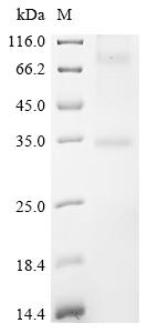 Recombinant Human Olfactory receptor 52D1 (OR52D1) - image 1