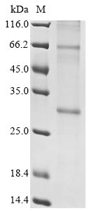 (Tris-Glycine gel) Discontinuous SDS-PAGE (reduced) with 5% enrichment gel and 15% separation gel. (Tris-Glycine gel) Discontinuous SDS-PAGE (reduced) with 5% enrichment gel and 15% separation gel.