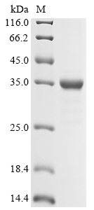 (Tris-Glycine gel) Discontinuous SDS-PAGE (reduced) with 5% enrichment gel and 15% separation gel. (Tris-Glycine gel) Discontinuous SDS-PAGE (reduced) with 5% enrichment gel and 15% separation gel.