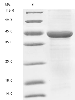 (Tris-Glycine gel) Discontinuous SDS-PAGE (reduced) with 5% enrichment gel and 15% separation gel. (Tris-Glycine gel) Discontinuous SDS-PAGE (reduced) with 5% enrichment gel and 15% separation gel.