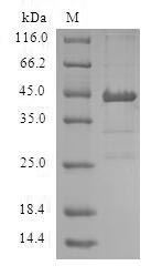 (Tris-Glycine gel) Discontinuous SDS-PAGE (reduced) with 5% enrichment gel and 15% separation gel. (Tris-Glycine gel) Discontinuous SDS-PAGE (reduced) with 5% enrichment gel and 15% separation gel.