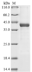(Tris-Glycine gel) Discontinuous SDS-PAGE (reduced) with 5% enrichment gel and 15% separation gel.