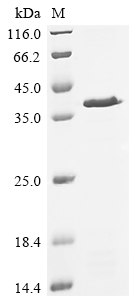 (Tris-Glycine gel) Discontinuous SDS-PAGE (reduced) with 5% enrichment gel and 15% separation gel.