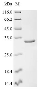 (Tris-Glycine gel) Discontinuous SDS-PAGE (reduced) with 5% enrichment gel and 15% separation gel. (Tris-Glycine gel) Discontinuous SDS-PAGE (reduced) with 5% enrichment gel and 15% separation gel.