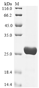 (Tris-Glycine gel) Discontinuous SDS-PAGE (reduced) with 5% enrichment gel and 15% separation gel. (Tris-Glycine gel) Discontinuous SDS-PAGE (reduced) with 5% enrichment gel and 15% separation gel.