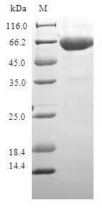 (Tris-Glycine gel) Discontinuous SDS-PAGE (reduced) with 5% enrichment gel and 15% separation gel. (Tris-Glycine gel) Discontinuous SDS-PAGE (reduced) with 5% enrichment gel and 15% separation gel.