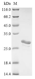 (Tris-Glycine gel) Discontinuous SDS-PAGE (reduced) with 5% enrichment gel and 15% separation gel. (Tris-Glycine gel) Discontinuous SDS-PAGE (reduced) with 5% enrichment gel and 15% separation gel.